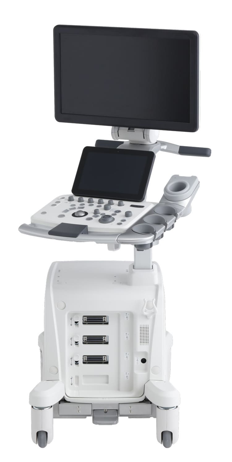 超音波検査装置